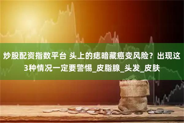 炒股配资指数平台 头上的痣暗藏癌变风险？出现这3种情况一定要警惕_皮脂腺_头发_皮肤